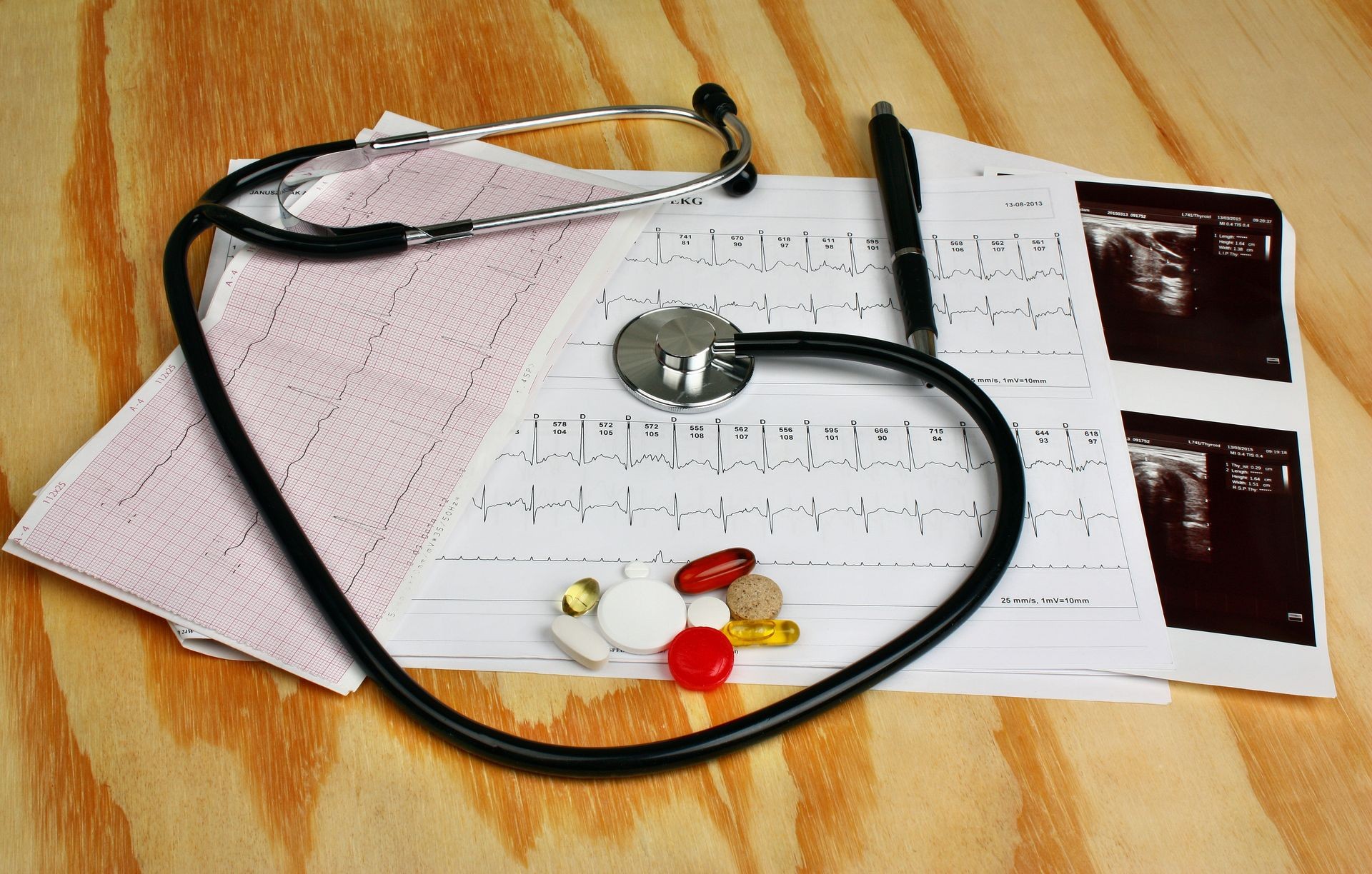 Cardiogram, ultrasound thyroid, stethoscope and  pills on a wooden table